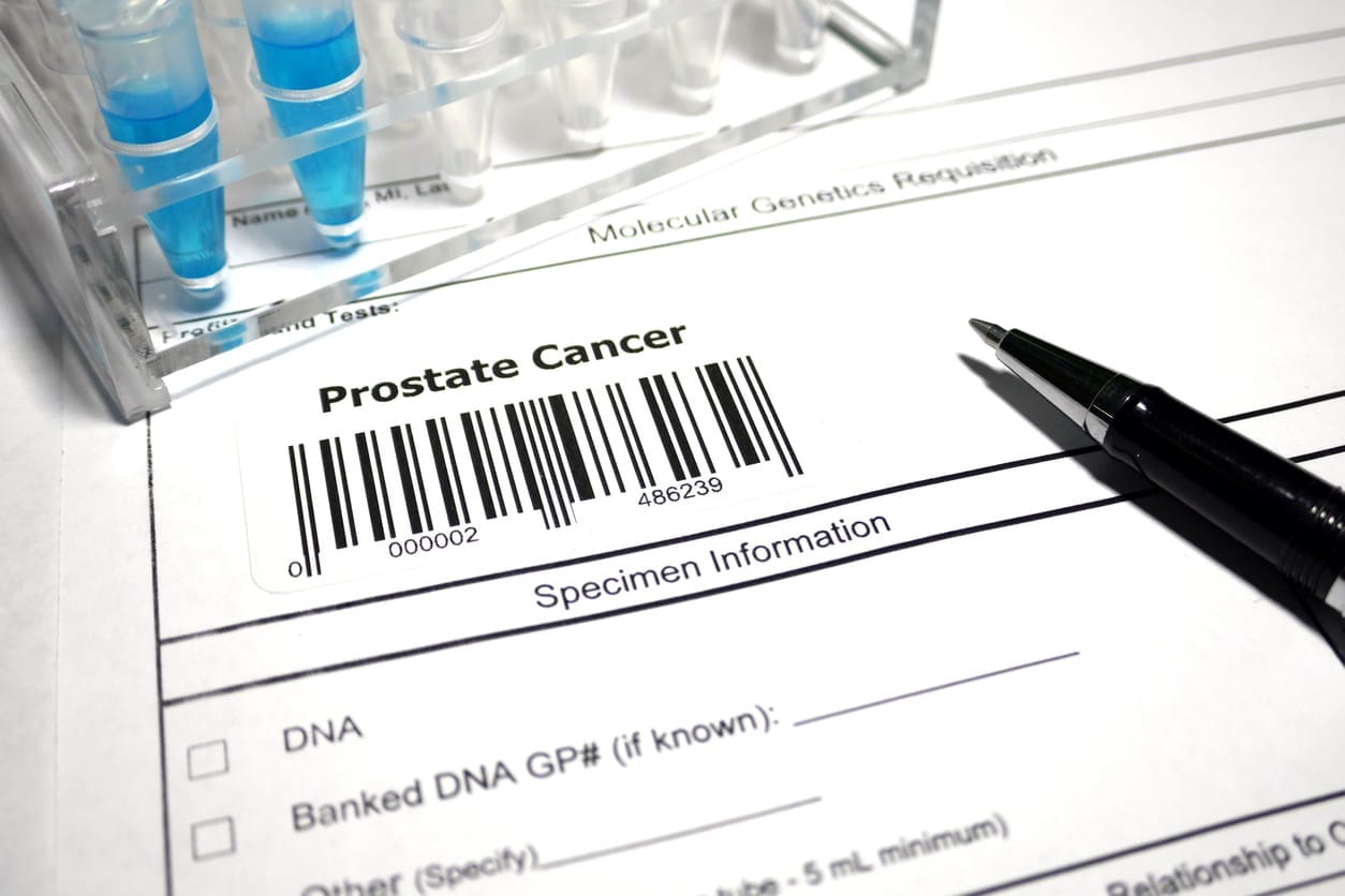 Prostate Cancer Document