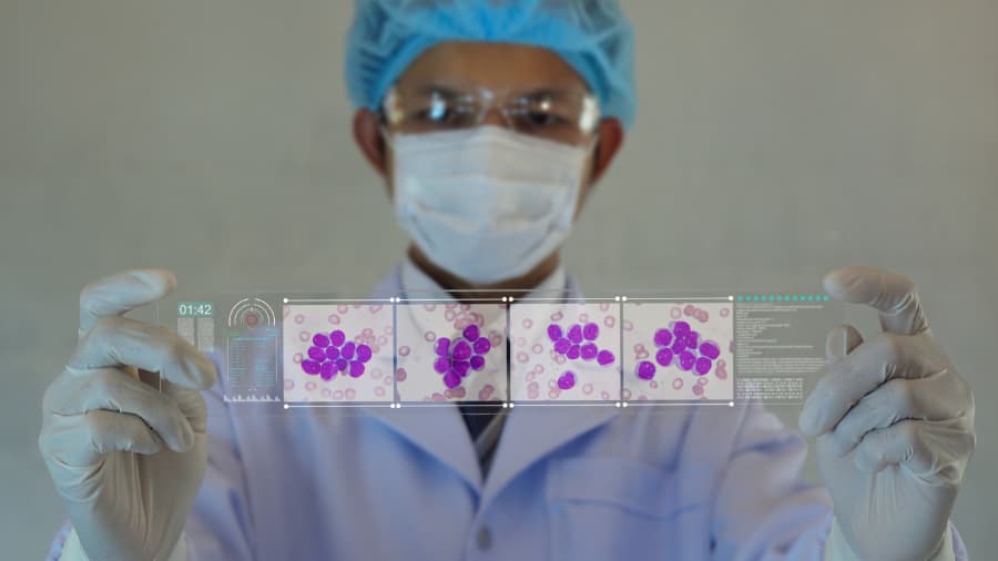 Doctor holding micrograph of leukemia cells